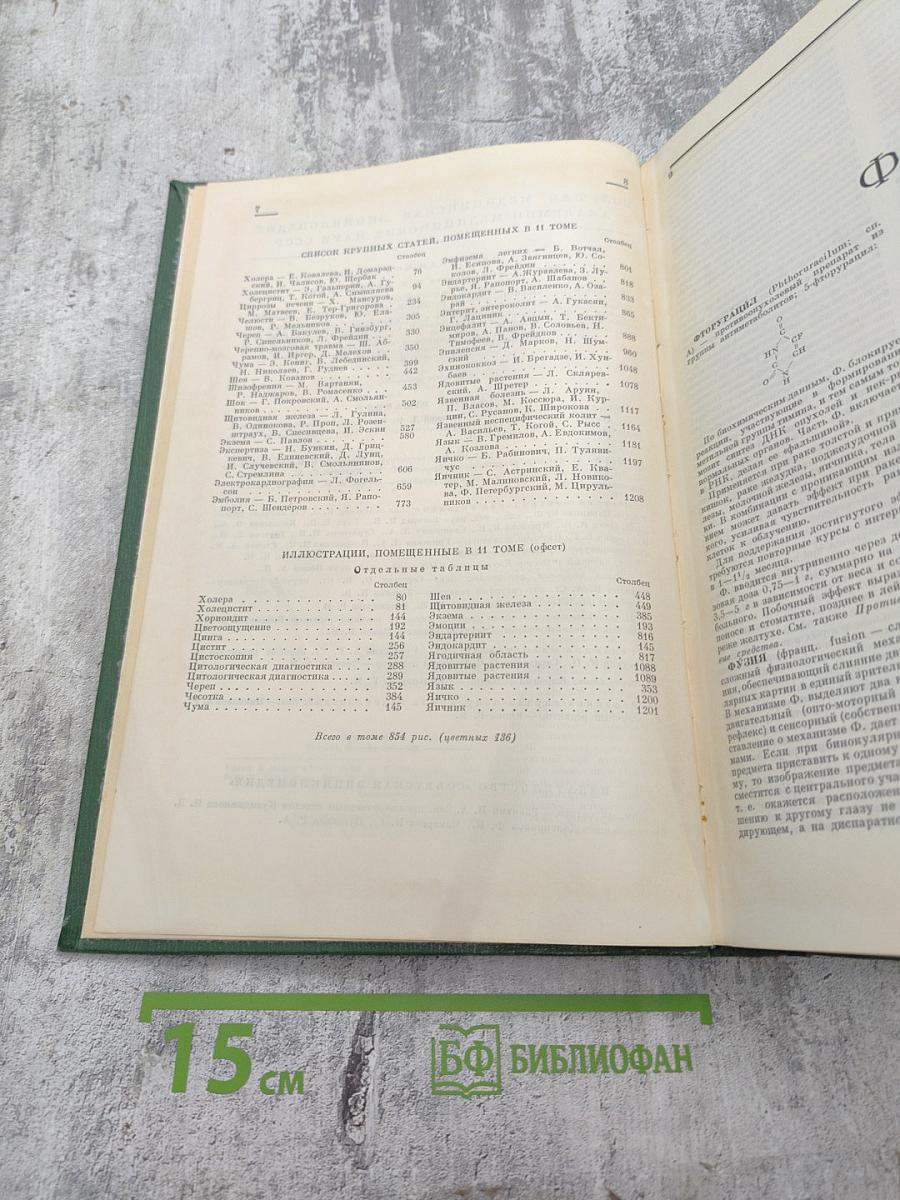 Малая медицинская энциклопедия. Том II: Фторурацил – Ящур