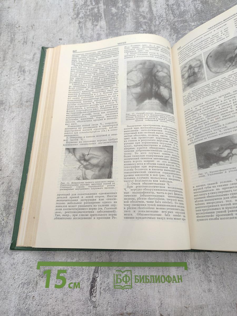 Малая медицинская энциклопедия. Том II: Фторурацил – Ящур