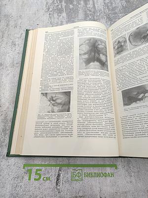 Малая медицинская энциклопедия. Том II: Фторурацил – Ящур