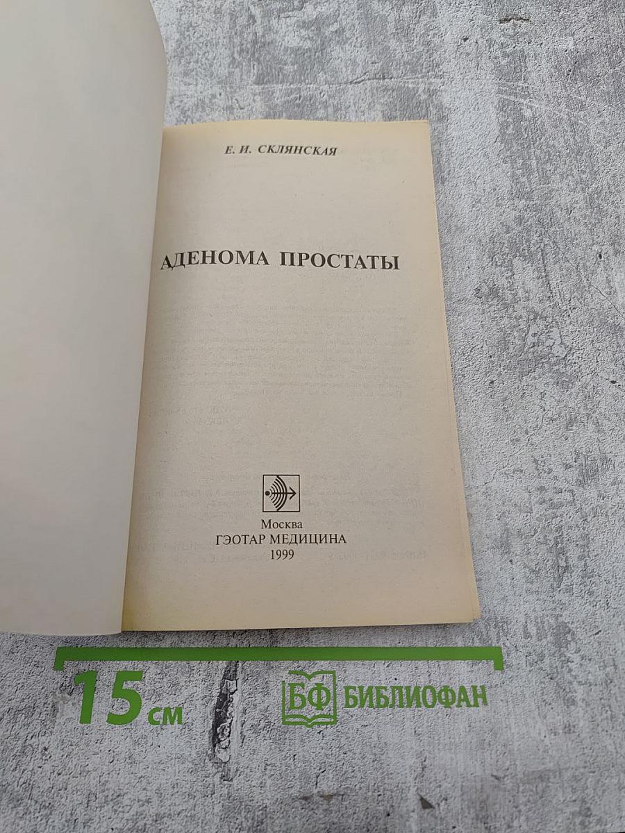 Аденома простаты