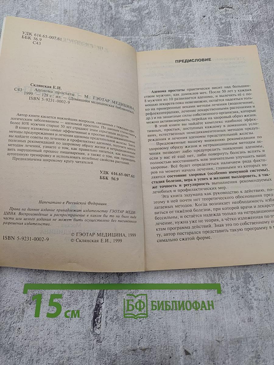 Аденома простаты