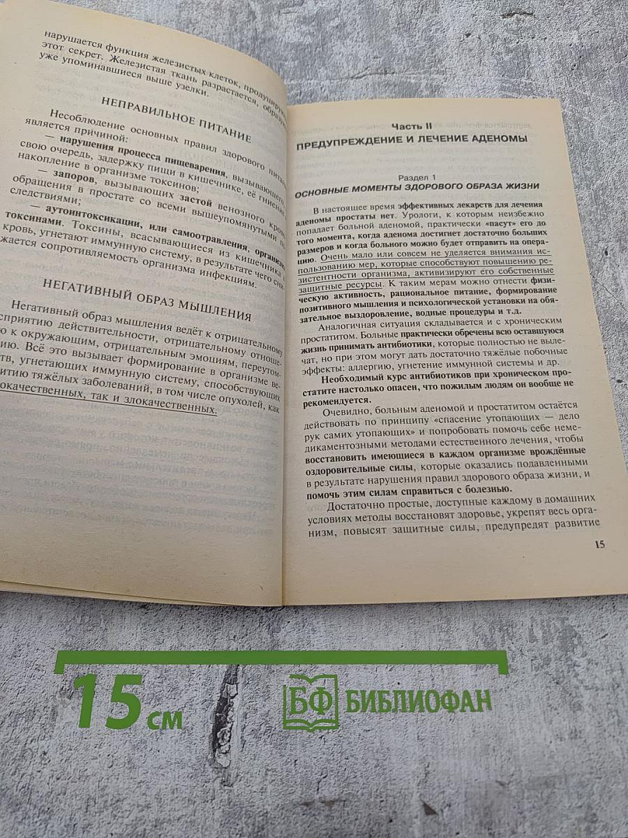 Аденома простаты