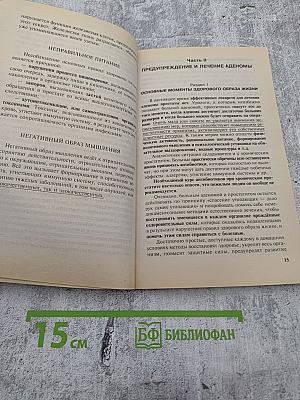 Аденома простаты