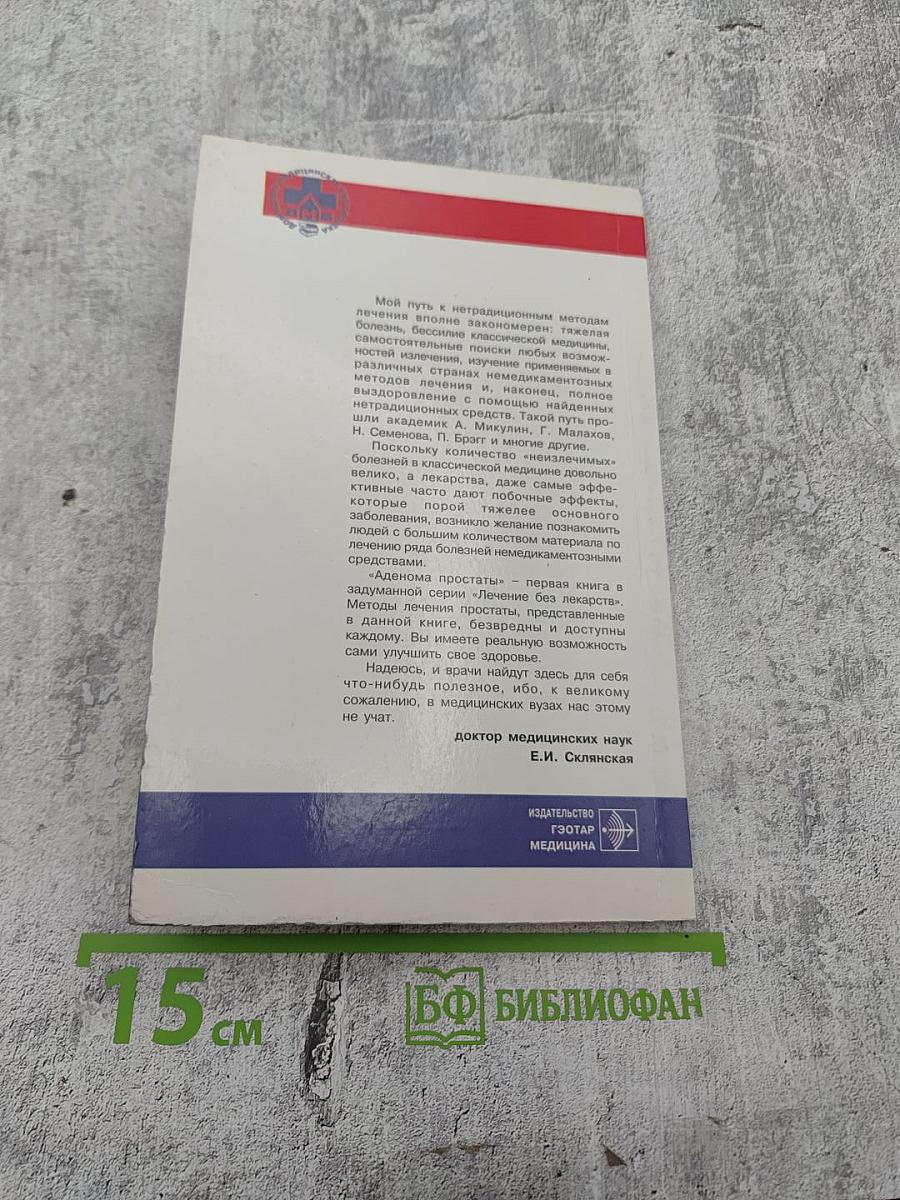 Аденома простаты