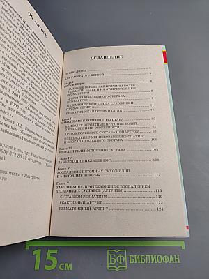 Боль в ногах