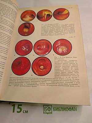 Внутренние болезни