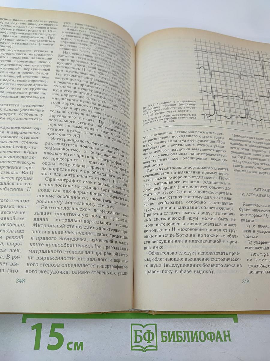 Болезни сердца и сосудов. Том 2. Руководство для врачей