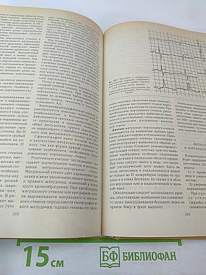 Болезни сердца и сосудов. Том 2. Руководство для врачей