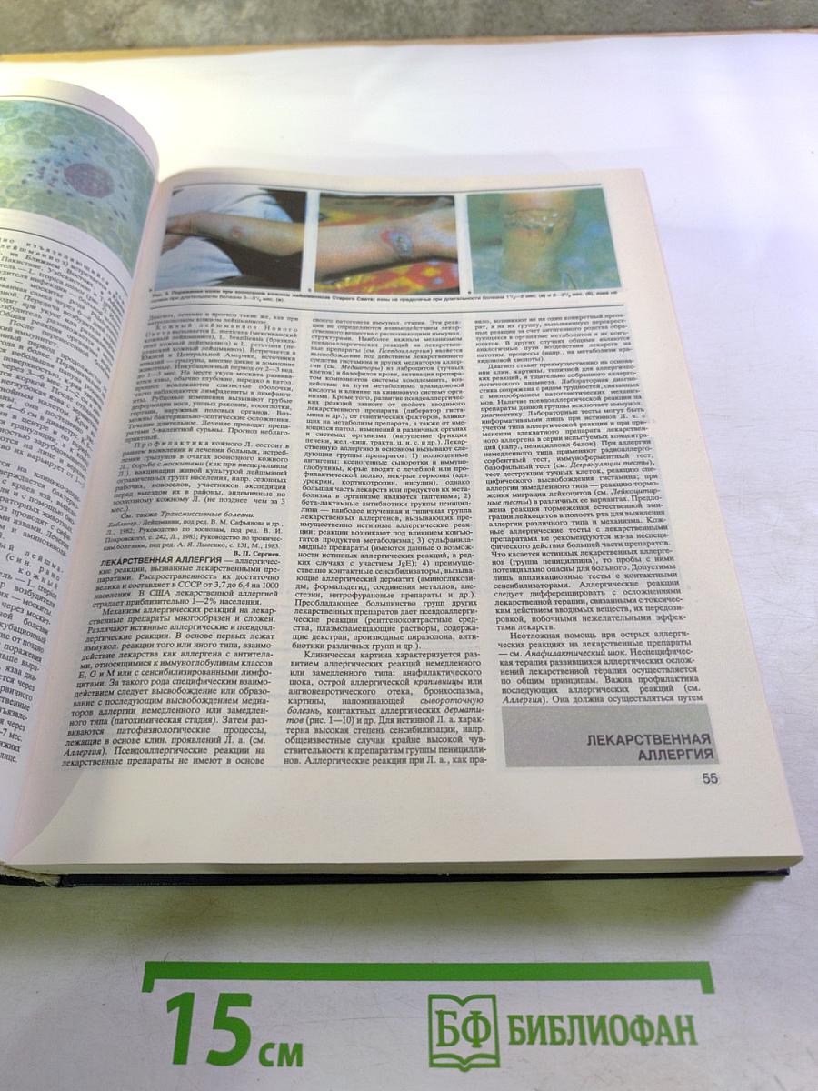 Малая медицинская энциклопедия, Том 3