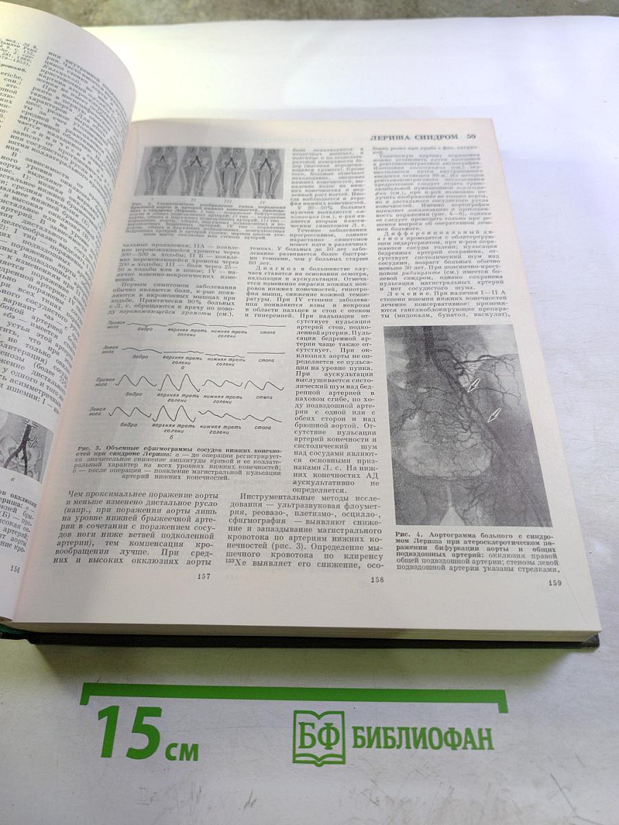 Большая медицинская энциклопедия, Том 13