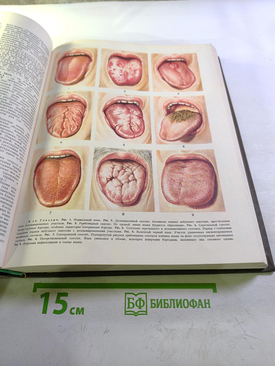 Большая медицинская энциклопедия. Том 6. Гипотиреоз – Дегенерация.