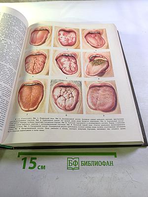 Большая медицинская энциклопедия. Том 6. Гипотиреоз – Дегенерация.