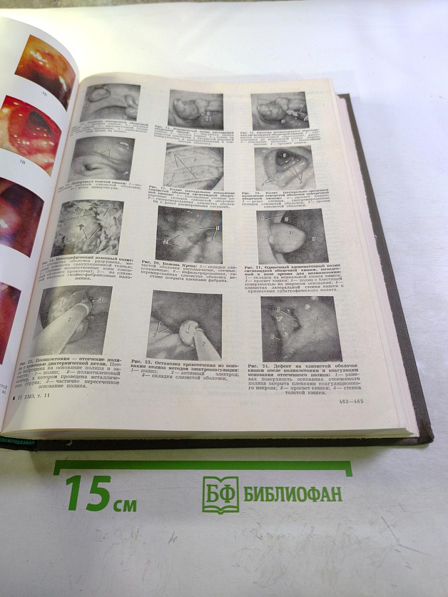 Большая медицинская энциклопедия. Том 11. Коамид—Криотерапия