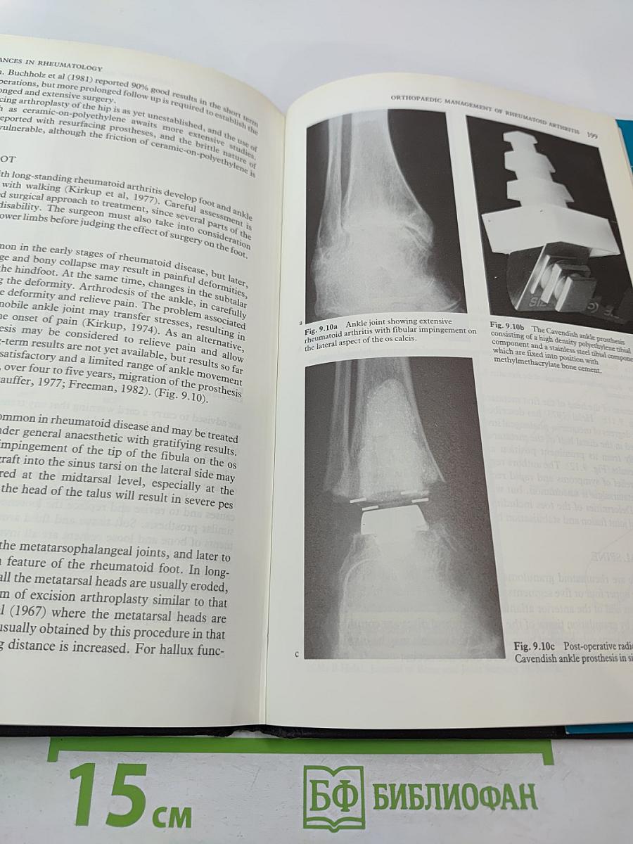 Recent Advances in Rheumatology, Number Three