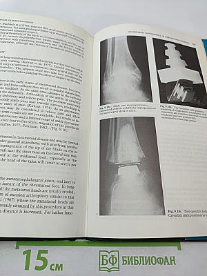 Recent Advances in Rheumatology, Number Three