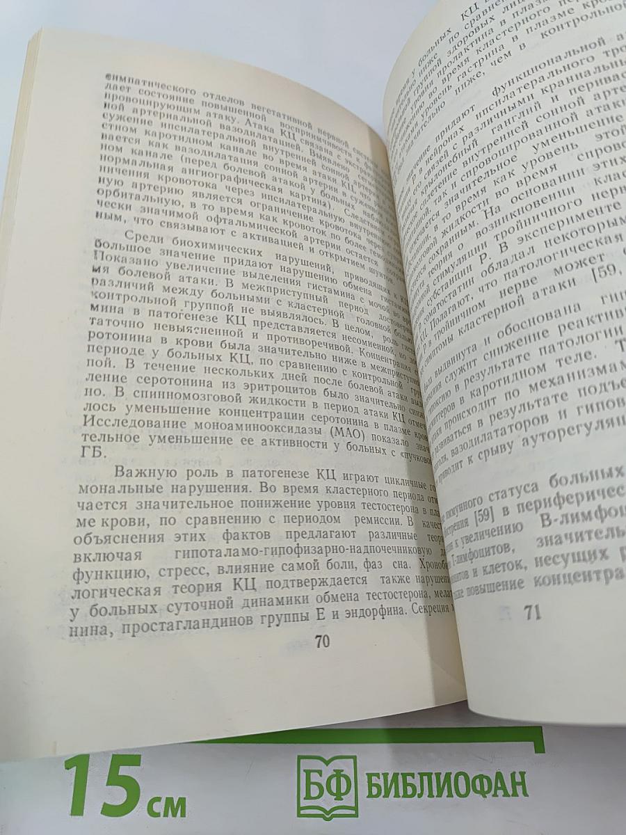 Головная боль (классификация, клиника, диагностика, лечение)