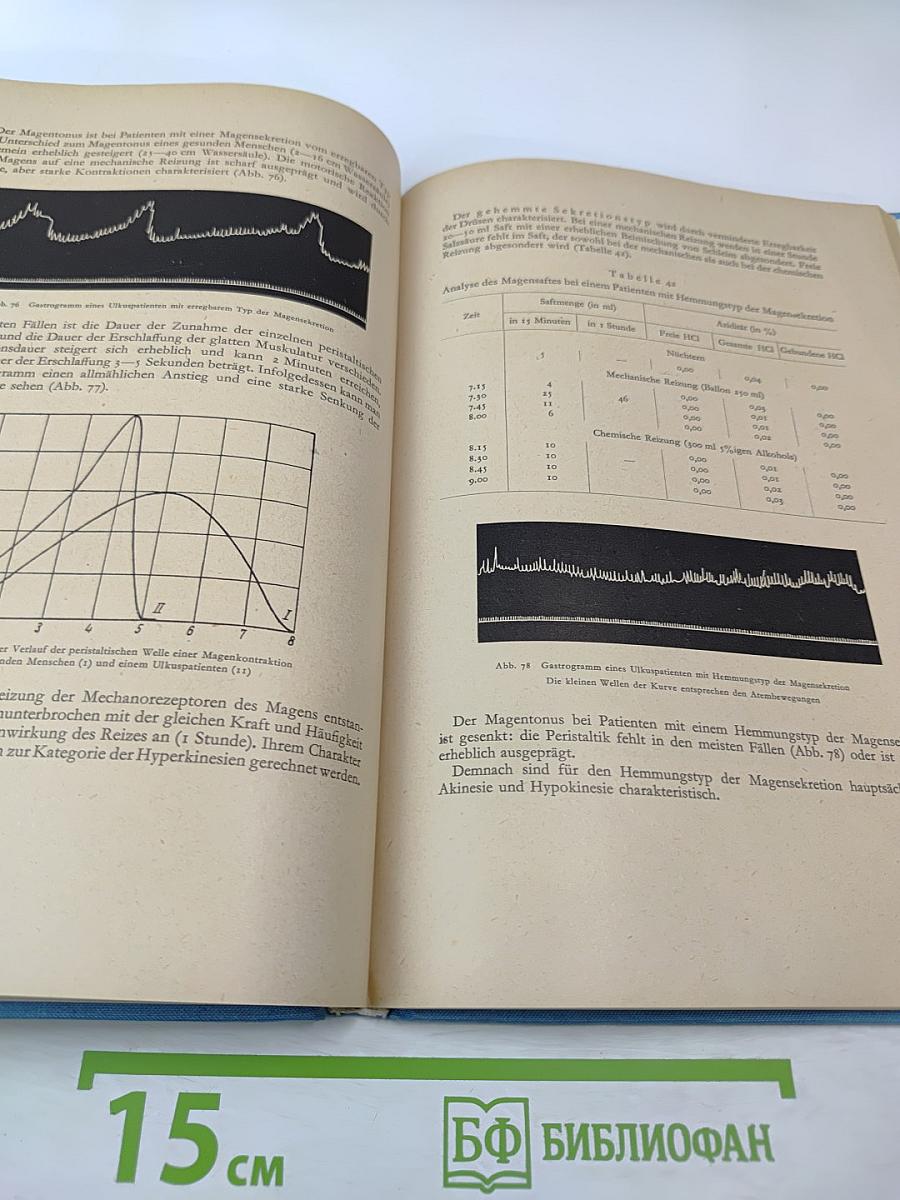 Kortiko-viszerale Pathogenese der Ulkuskrankheit
