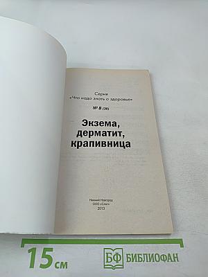 Экзема, дерматит, крапивница