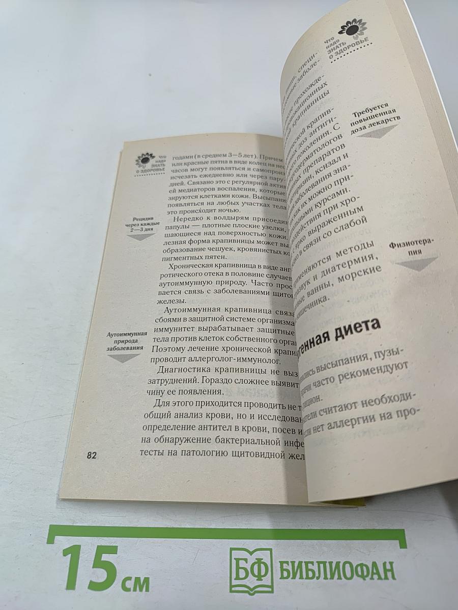 Экзема, дерматит, крапивница