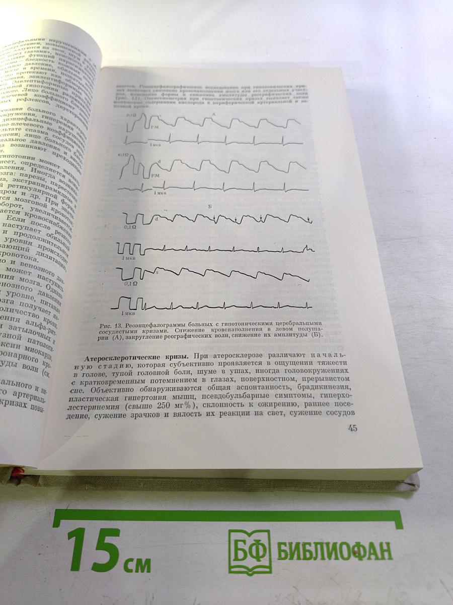 Церебральные кризы и инсульт