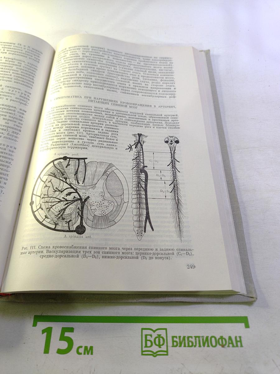Церебральные кризы и инсульт