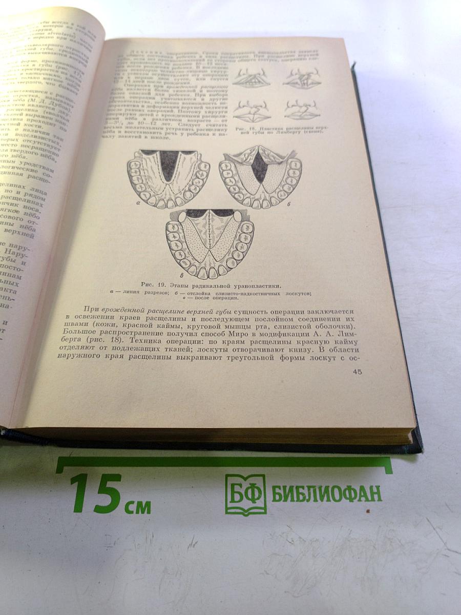 Хирургические болезни