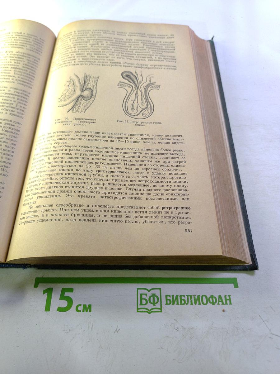 Хирургические болезни