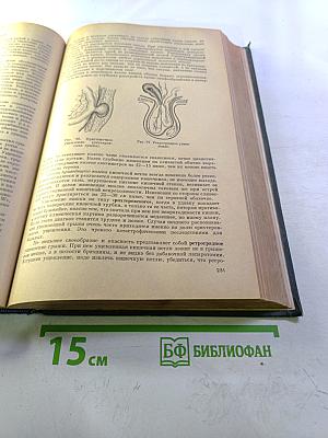 Хирургические болезни