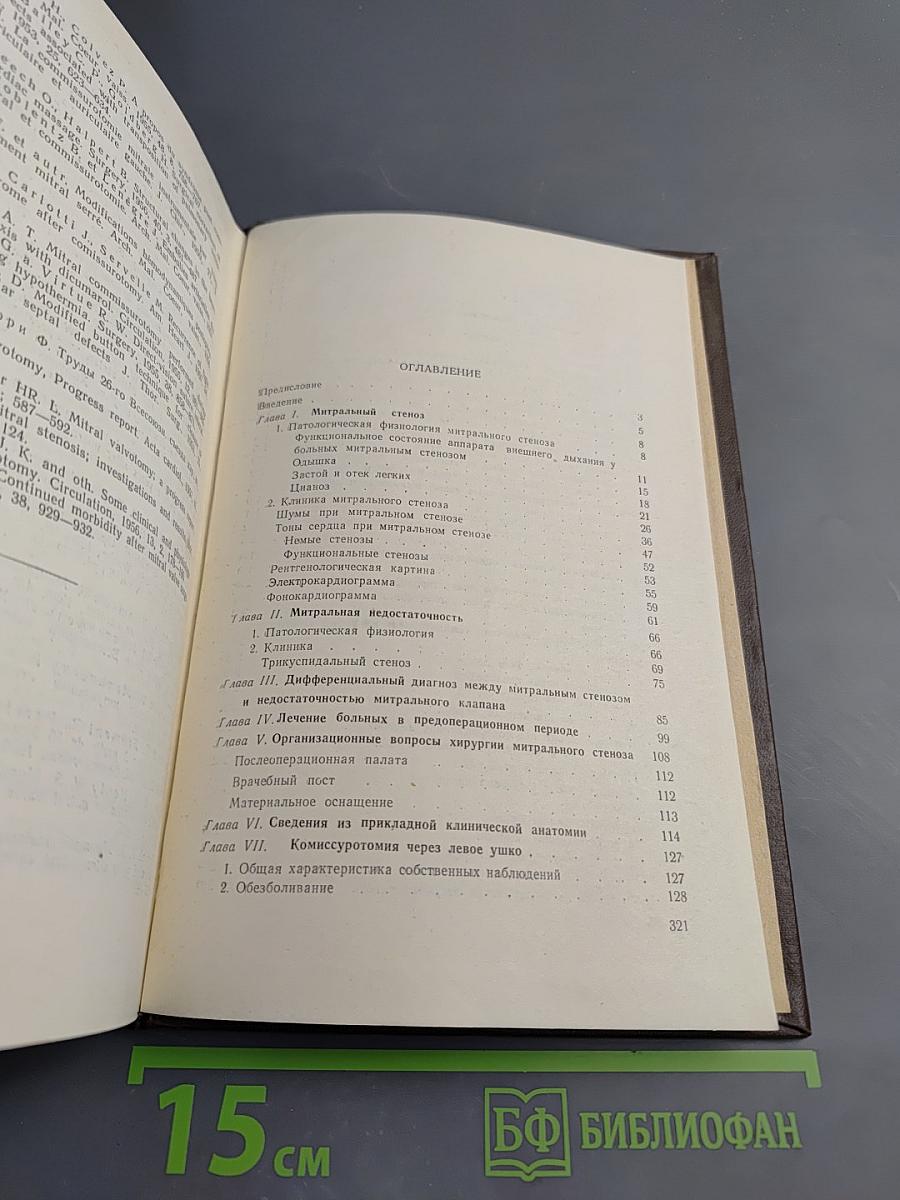 Митральный стеноз в освещении терапевта и хирурга