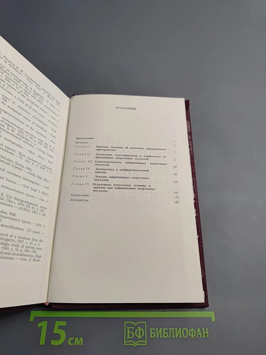 Забрюшинные опухоли