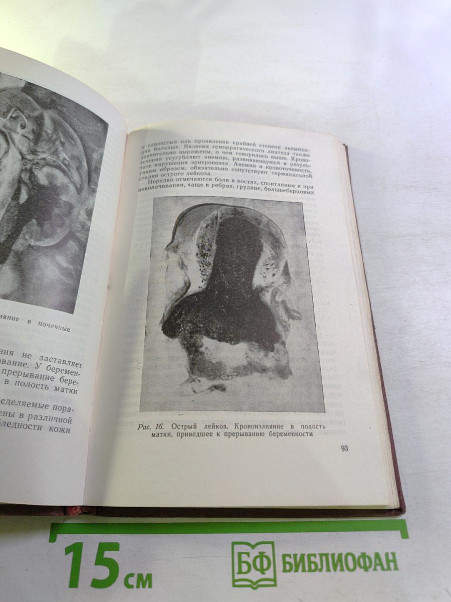 Очерки клинической гематологии