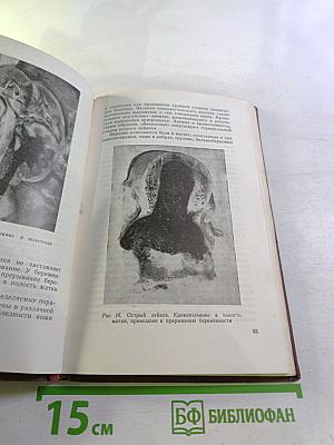 Очерки клинической гематологии