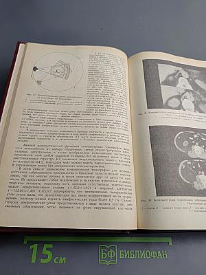 Руководство по гематологии. Том 1