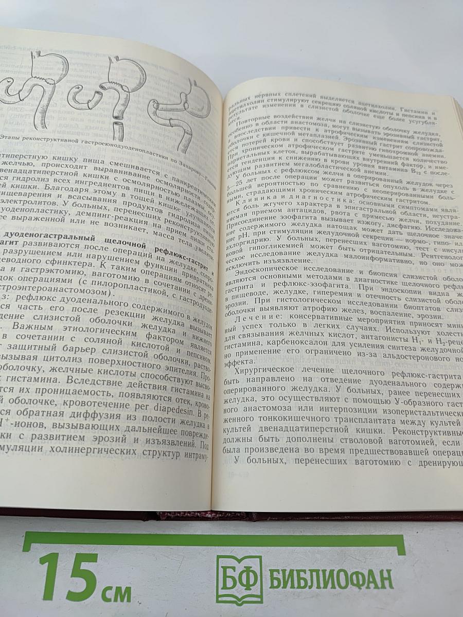 Хирургические болезни
