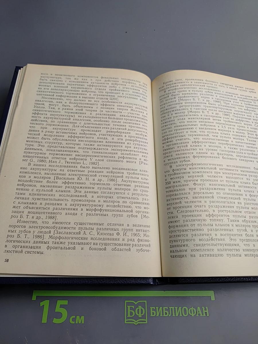 Акупунктурная анальгезия. Экспериментально-клинические аспекты