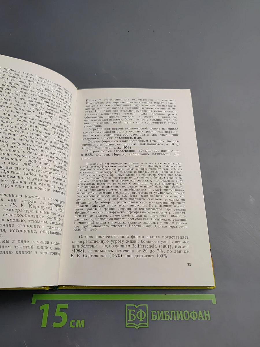 Клинико-рентгенологическая диагностика неспецифического язвенного колита