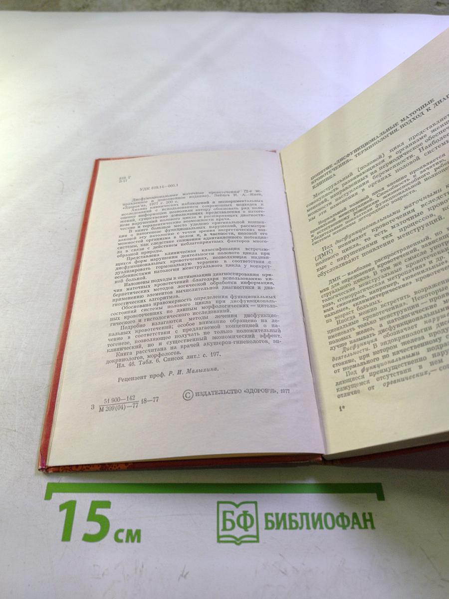 Дисфункциональные маточные кровотечения