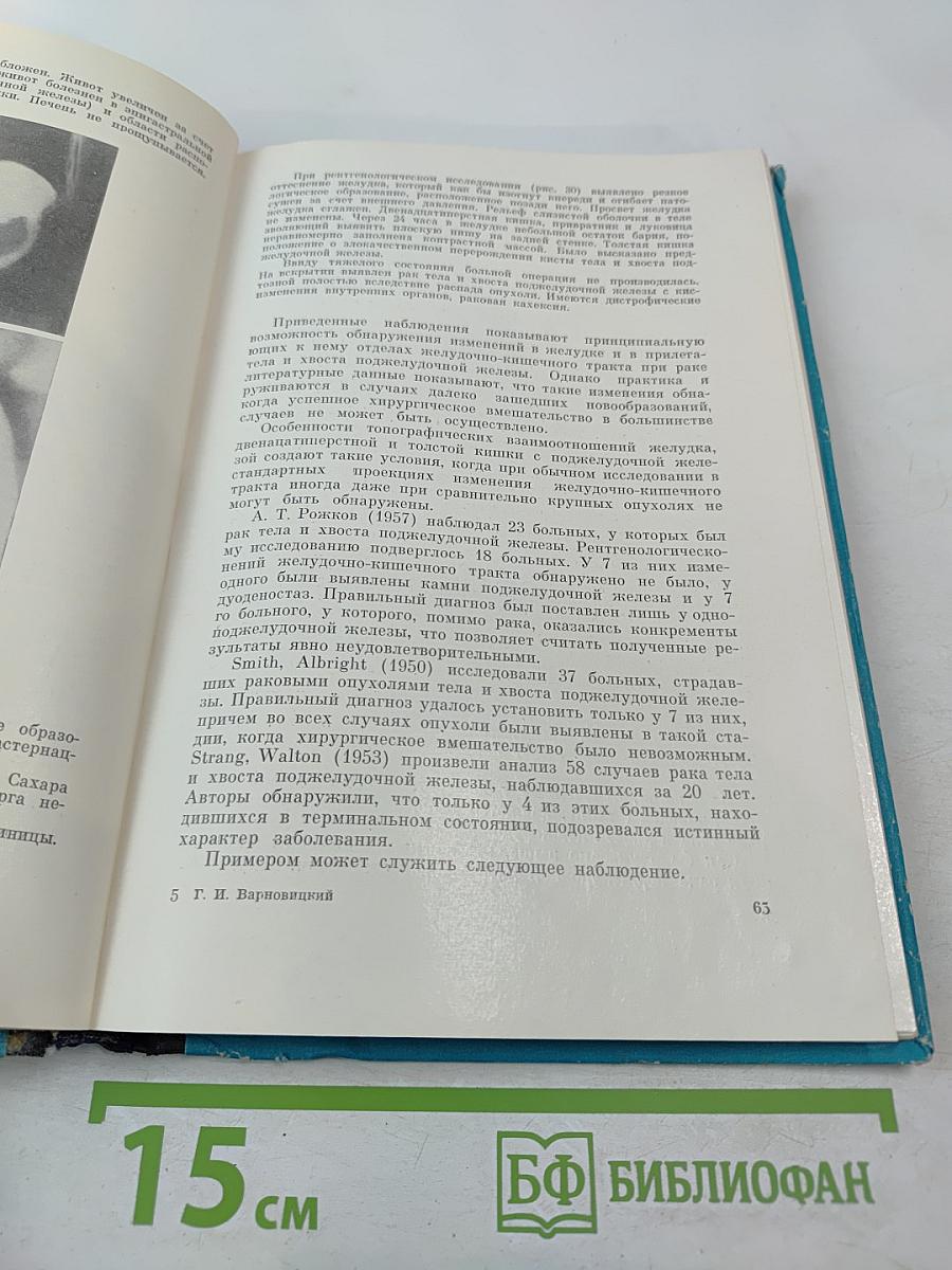 Рентгенодиагностика заболеваний поджелудочной железы (Клинико-рентгенологические наблюдения)