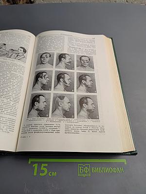 Малая медицинская энциклопедия. Том 8: Полифагия - Геометры