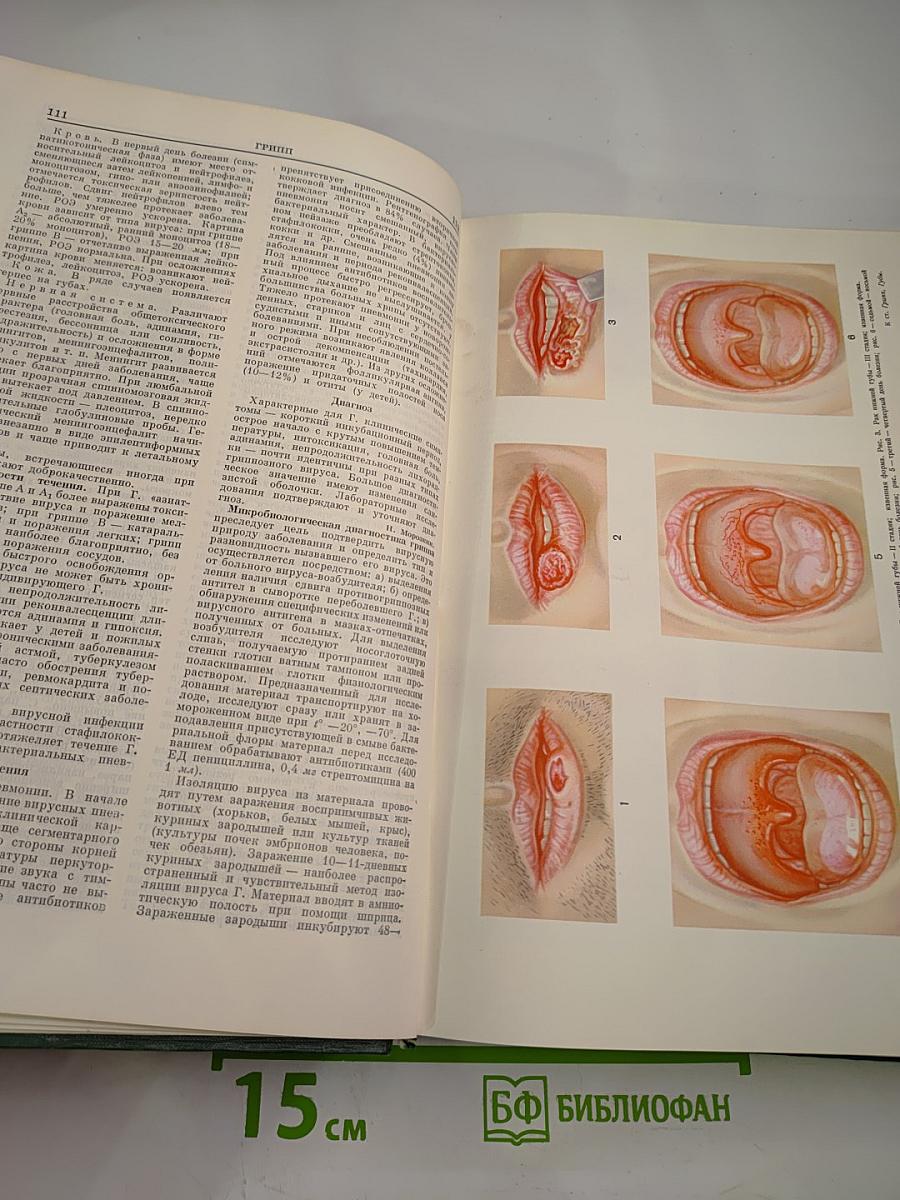 Малая медицинская энциклопедия. Том 3: Гонит - Интубатор