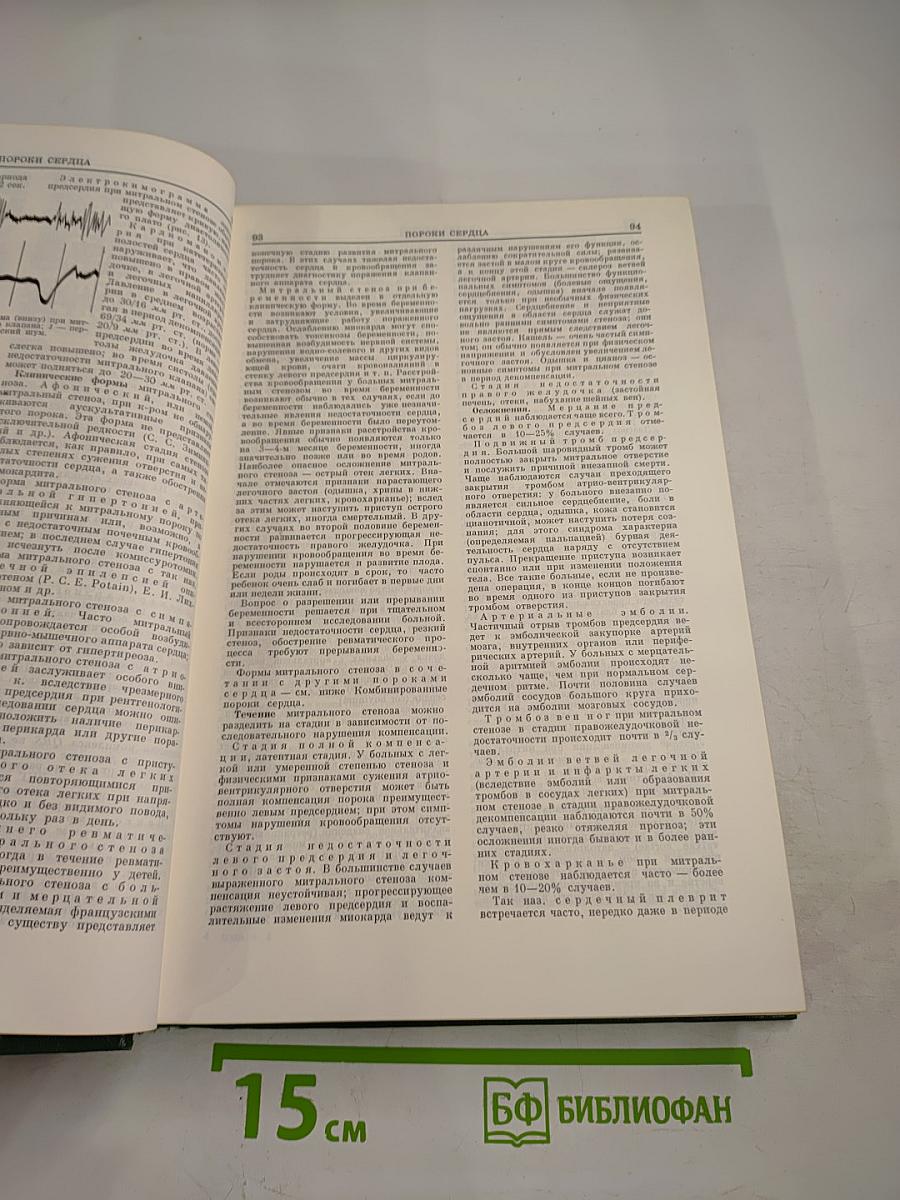 Малая медицинская энциклопедия. Том 8: Полифагия - Реометры