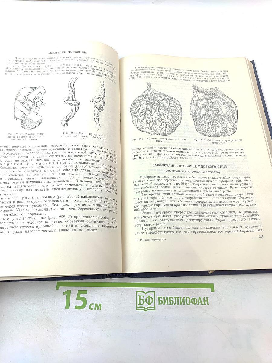 Учебник акушерства