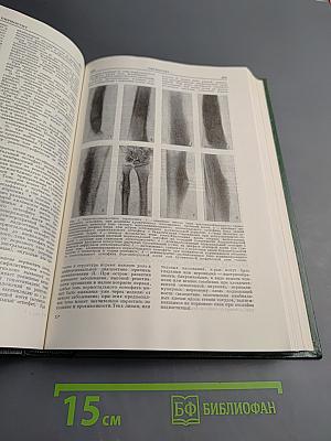 Малая медицинская энциклопедия. Том 7: Отравления - Полиурия