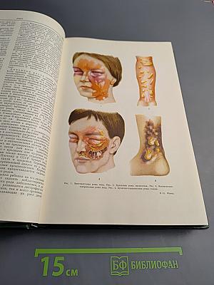 Малая медицинская энциклопедия Том 9: Репелленты - Спорынья