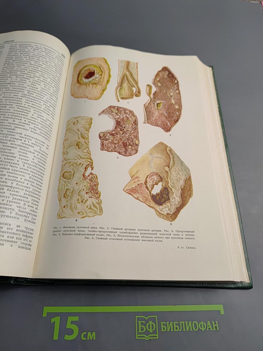 Малая медицинская энциклопедия. Том 9: Репелленты - Спорынья