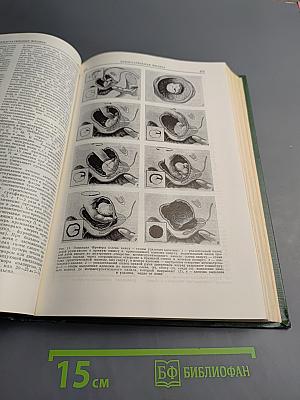 Малая медицинская энциклопедия. Том 8. Полифагия – Реометры