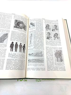 Малая медицинская энциклопедия, Том 4: Интубация - Ларокаин