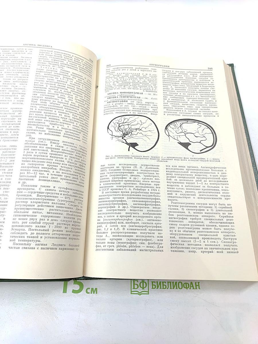Малая медицинская энциклопедия. Том 1. А – Бронхит