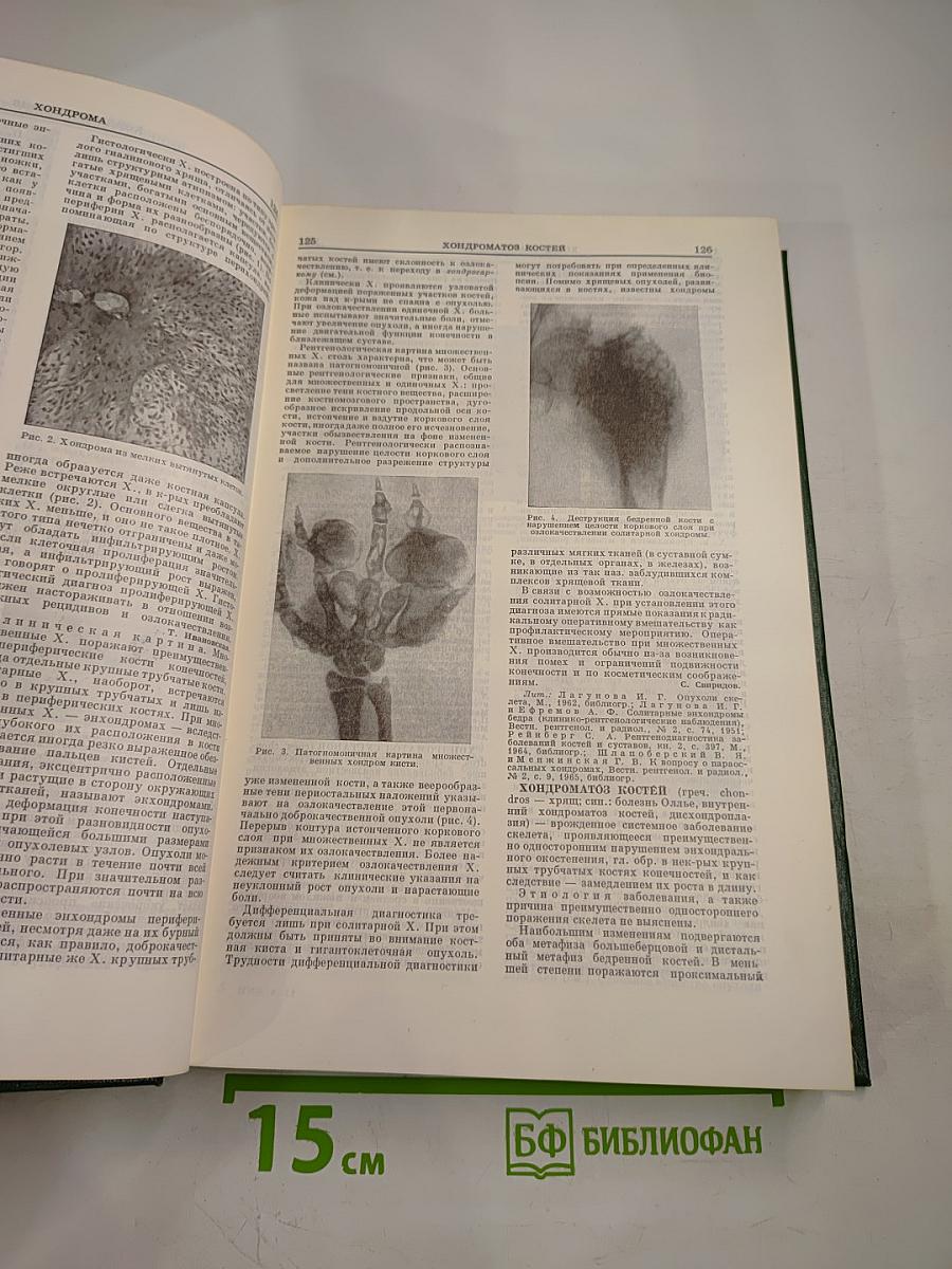 Малая медицинская энциклопедия. Том 11. Фторурацил – Ящур