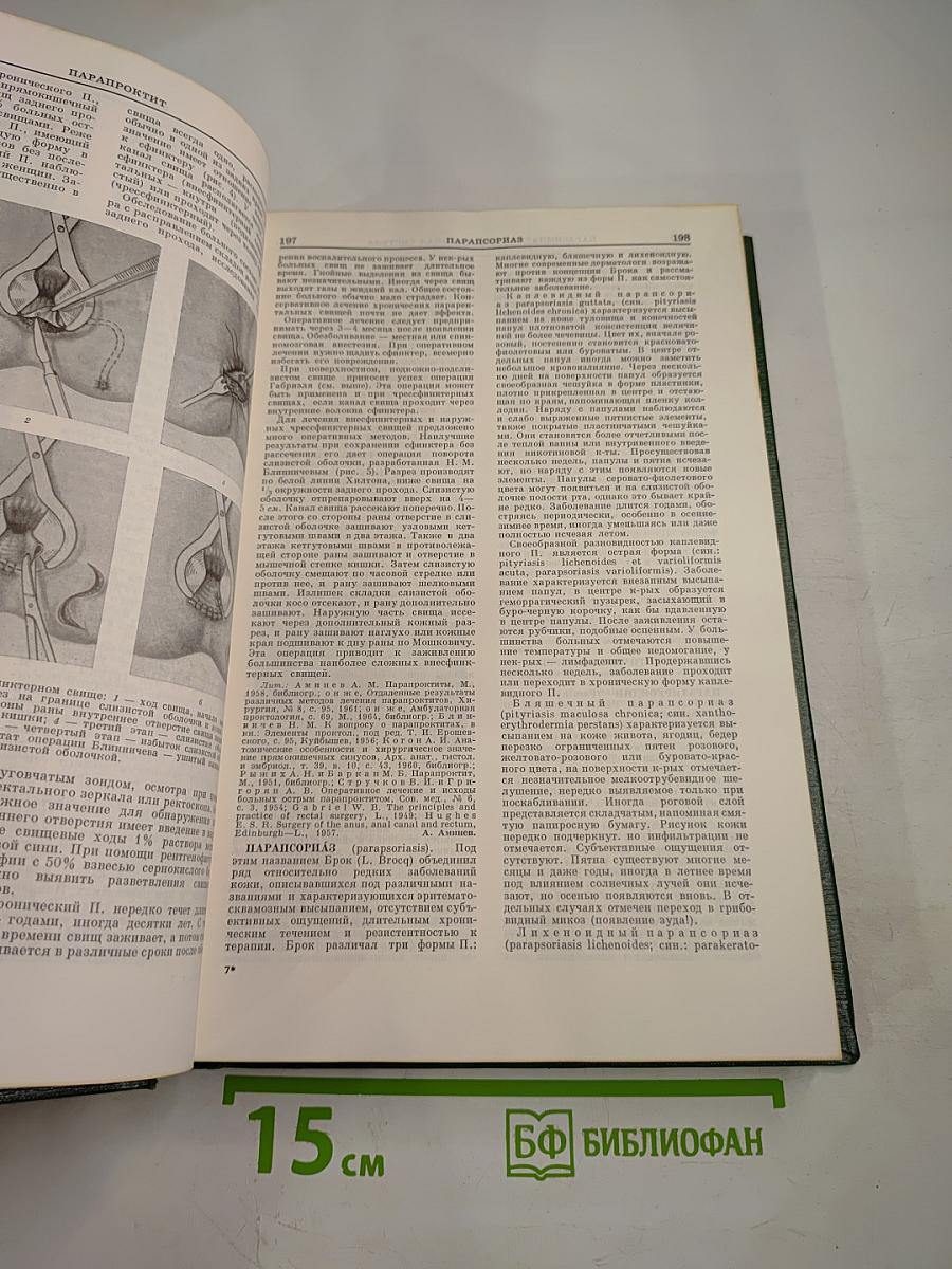 Малая медицинская энциклопедия. Том 7: Отравления - Полиурия